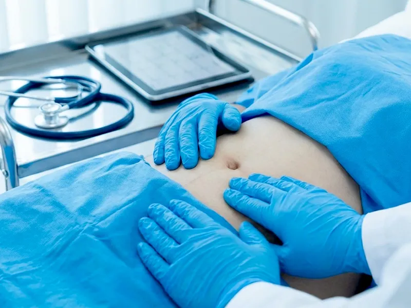 Can Appendicitis Cause Abdominal Distension