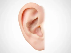 How to Open a Blocked Ear at Home