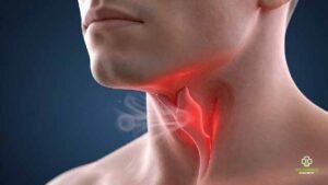 How Do I Stop My Tickly Cough