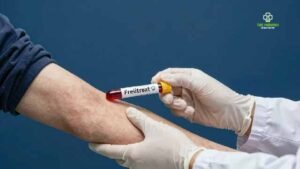 What Is an FBC Blood Test and What Does It Show?
