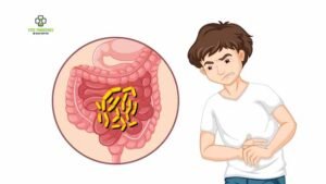 Do I Need the Cholera Vaccine for My Holiday